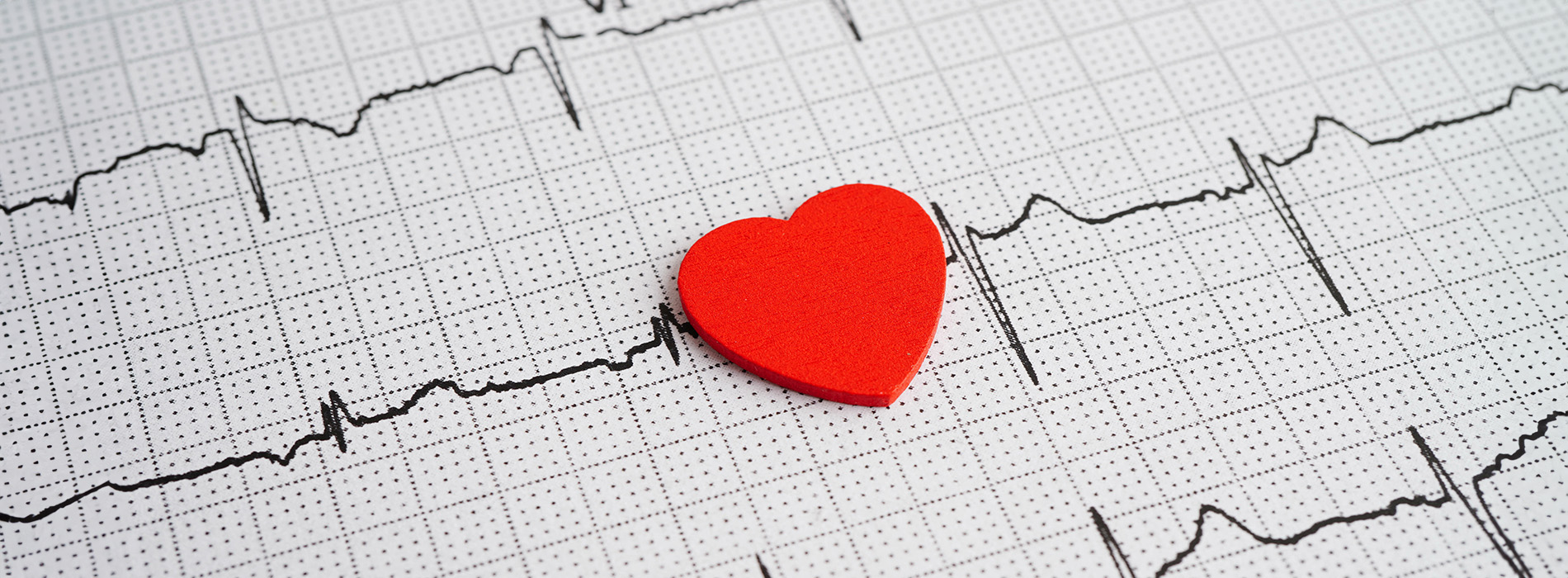 An ECG heartbeat chart with a small red heart placed on top of it.