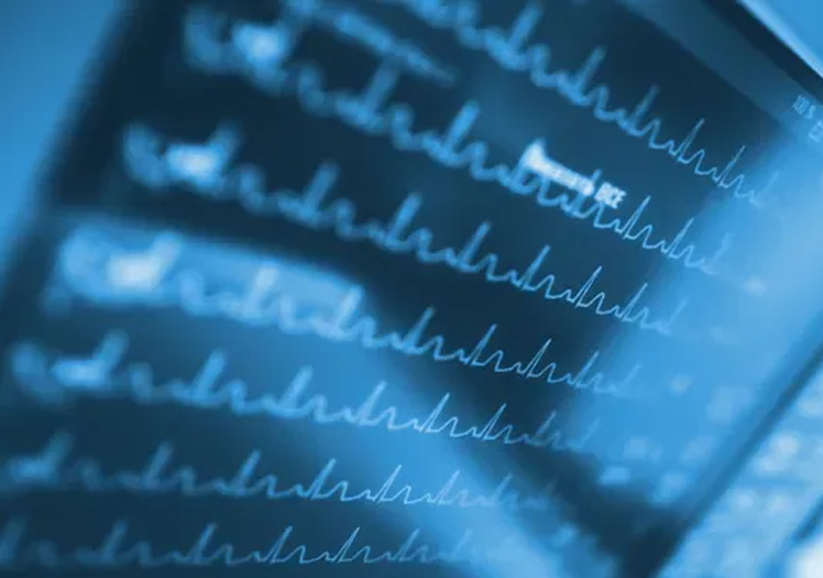 The image displays a close-up view of a computer screen with various medical charts and graphs, predominantly in shades of blue and white, suggesting a healthcare or medical context.
